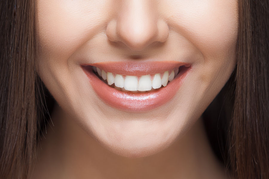 Photograph of the lower half of a woman's face with a bright, white smile.