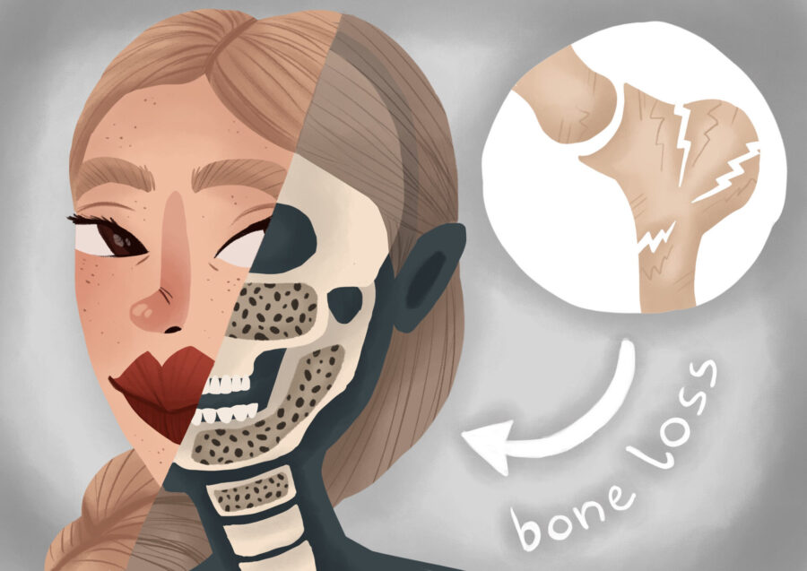 woman with jawbone loss