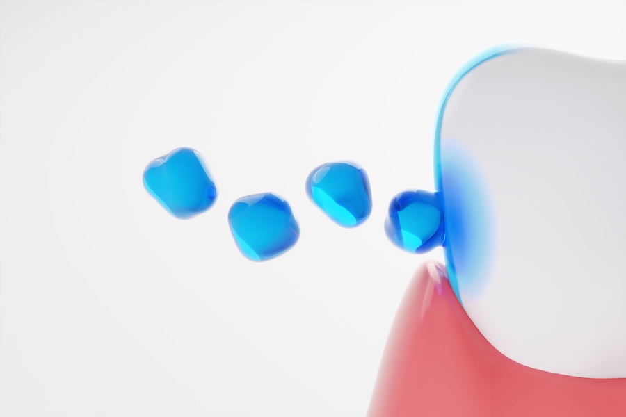 fluoride varnish fluoride treatment for sensitive teeth tooth sensitivity