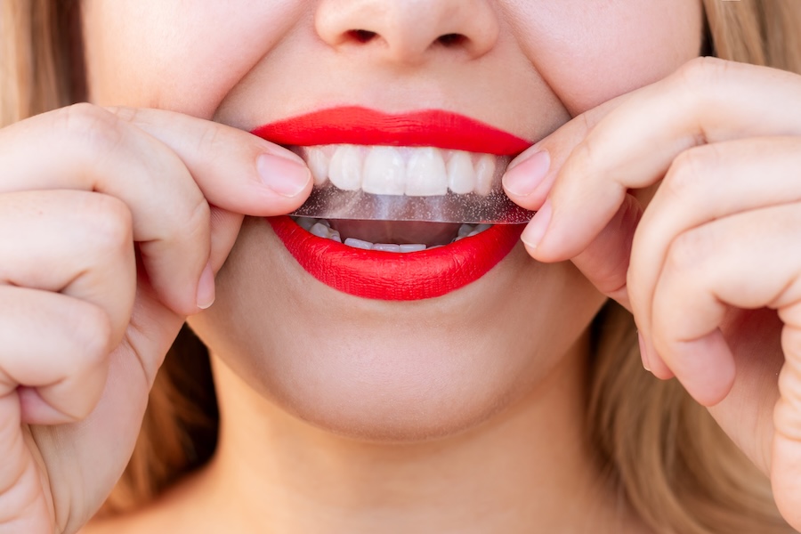woman using whitening strips